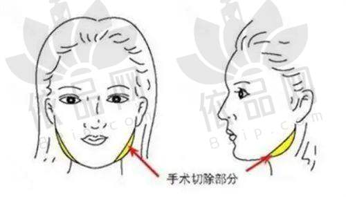 南京华美许红丽医生：特色技术与优势