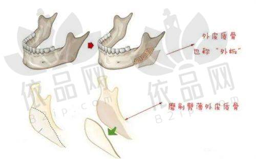 钟伟洪 — 深圳人民医院整形外科