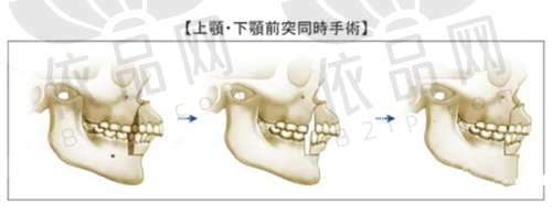 华 西医院整形美容科：拉皮提升、抗初老手术推荐医生