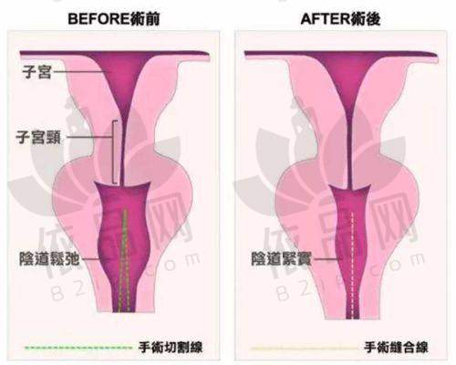 吕光全：口碑评价