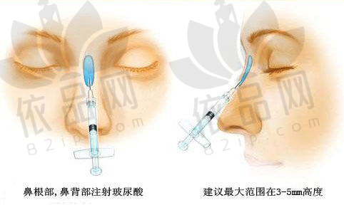 从王志军 医生实例看：为什么说他的拉皮术“贵得有道理”
