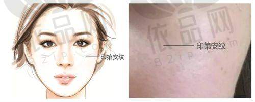 昆明韩辰医疗美容医院 正规吗