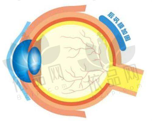 四、南宁佰视佳眼科精 雕个性化飞秒手术的价格