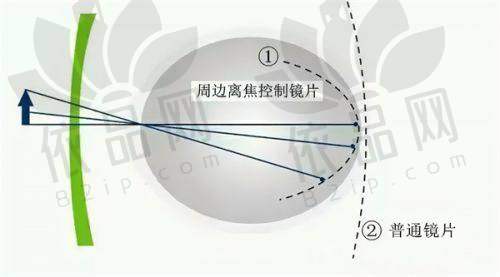 西双版纳艾维眼科医院——预约方式