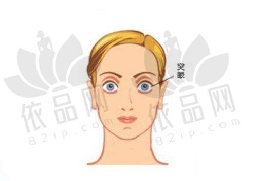 总结