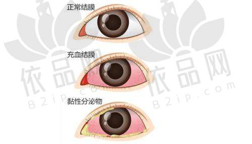 徐州华厦眼科医院预约方式