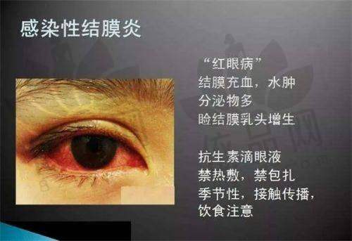徐州华厦眼科医院收费价格表