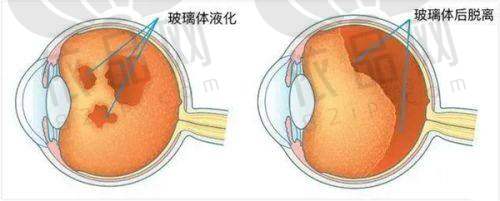 洪林勇医生：严谨细致，让患者安心手术