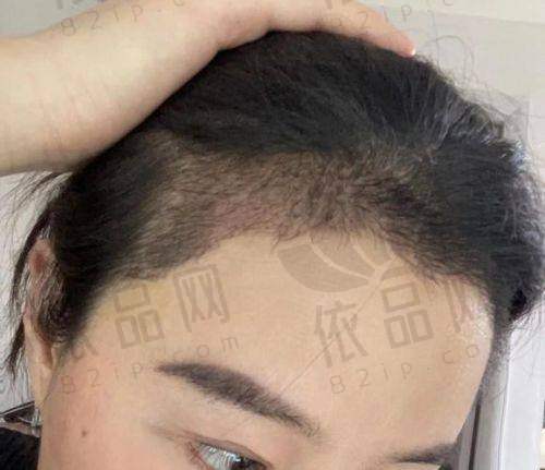 任厚杰医生预约方式