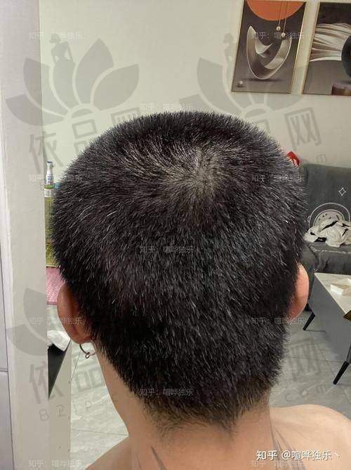 任厚杰医生口碑评价