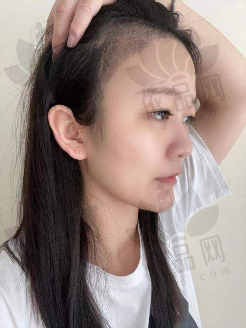任厚杰医生擅长项目