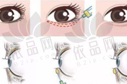 华中科技大学协和深圳医院美容整形科：有保护的医美选择