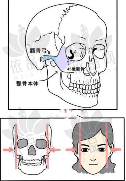 二、国产硅胶假体