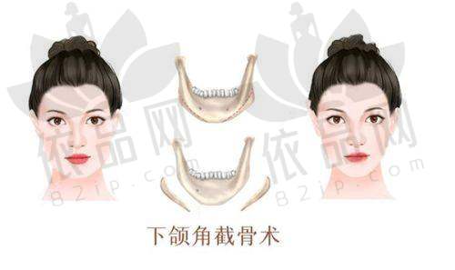 深圳非凡医疗美容医院：多年沉淀，覆盖项目丰富