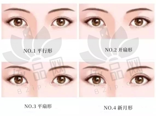殷初阳隆胸手术情况怎样？