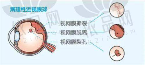 三、昆明眼科医院的预约挂号方式