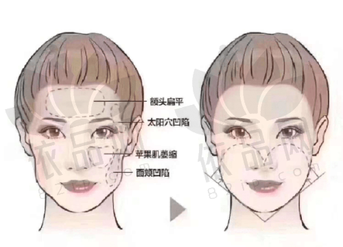 外地客户到深圳美莱整形医院的交通攻略