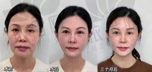 北京雅靓医疗美容作为一家有着二十多年发展历史的机构，无论是在资质合规性、医生手法、特色项目，还是用户体验评分方面，都表现得相对靠谱。尤其对少女针、热玛吉、面部整形类的项目提供了较成熟的方案和支持，结合用户的实际反馈，可以看出这是一家服务和口碑都在不断积累的医美机构。如果你正在北京寻找一个相对安心的医美体验，不妨了解一下北京雅靓医疗美容的线下服务和诊疗流程，提前在线询问或者到院了解详情，会更加安心地迈出变得更美这一步。