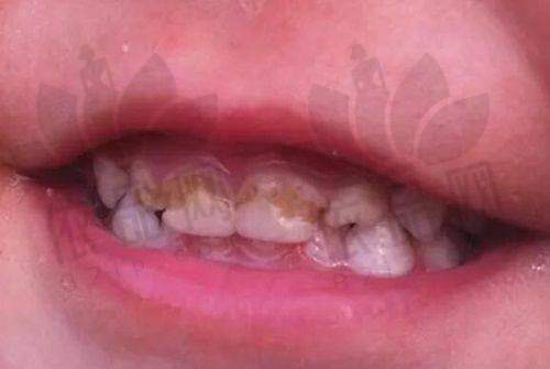 就诊体验有哪些不足？