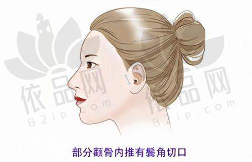 长春融美医疗美容侯彦冰医生口碑评价