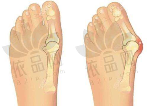 长沙鹏爱医疗美容：微信预约方式更方便快捷