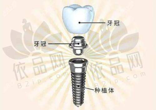 长春卓越口腔高景峰医生：口碑评价