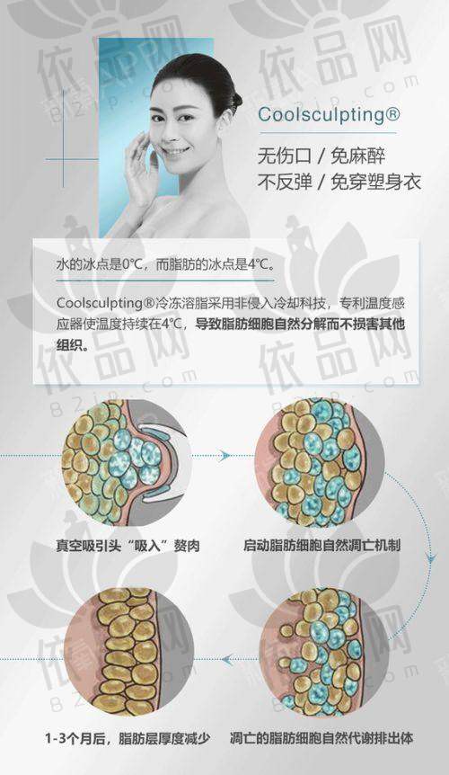 嗨体去颈纹的原理