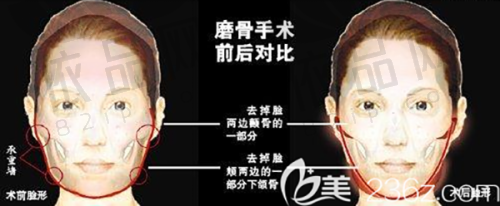 长沙鹏爱医疗美容医院预约方式