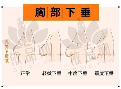 国内私密整形在线询问的服务内容