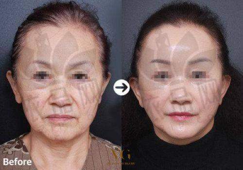 海南华美医学美容医院：项目丰富环境优雅