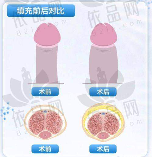 选择上海虹桥医院疤痕科的优势
