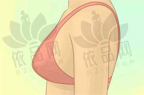 三、手术价格：合理透明，性价比高