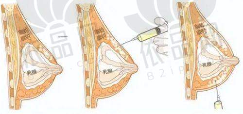 哈尔滨领艺医疗美容门诊部预约方式