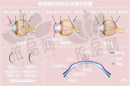 延吉爱尔眼科医院免费咨询、预约挂号全攻略，多种方式任你选，附收费价目表