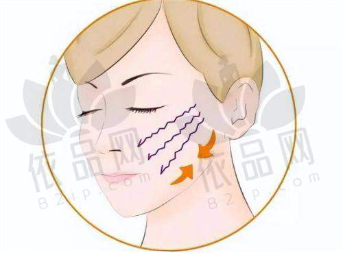 上海医院疤痕修复选择建议