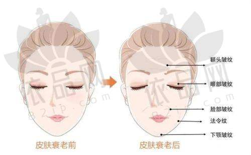 吉林中妍整形赵胜有小拉皮38000元起，紧致抗衰效果好，专属方案超贴心