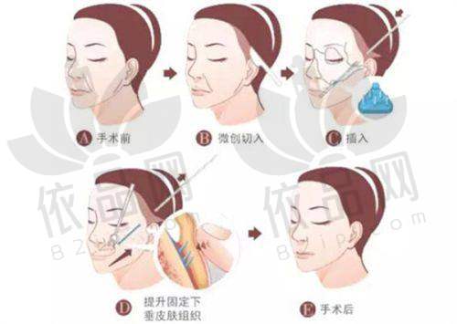 哈尔滨双举疤痕专科门诊部结语