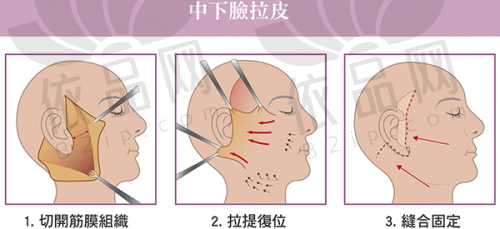总结