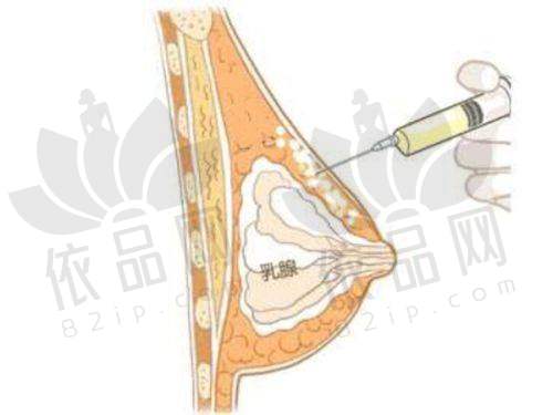 东莞西妃医疗美容是正规医院吗？从审批、规模等多方面看答案是肯定的