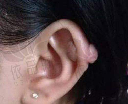 总结与询问引导
