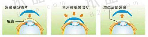 白城爱尔眼科医院正规吗