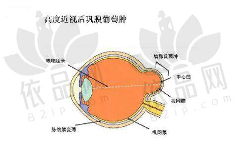 口碑方面对比：患者评价谁更优