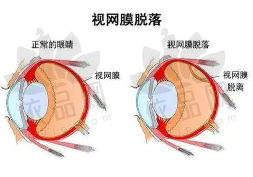 延吉爱尔眼科医院收费价格表