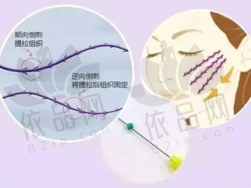 哈尔滨美辰整形医院预约方式
