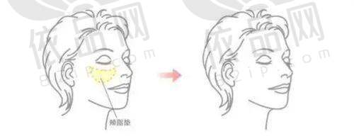 郑方荣医生馒化脸修复的优势