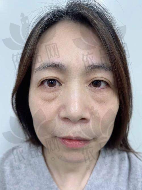 姚刚 | 南京医 科 大学第一附属医院 - 烧伤整形科