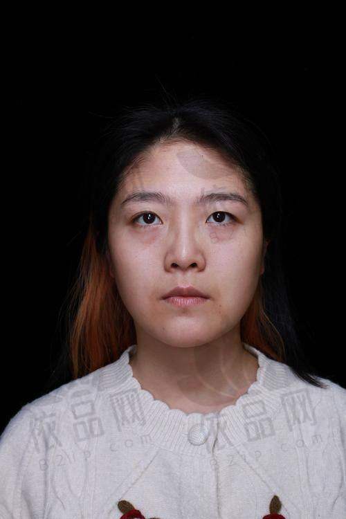 选择广州美莱陈贵宗祛眼袋的理由