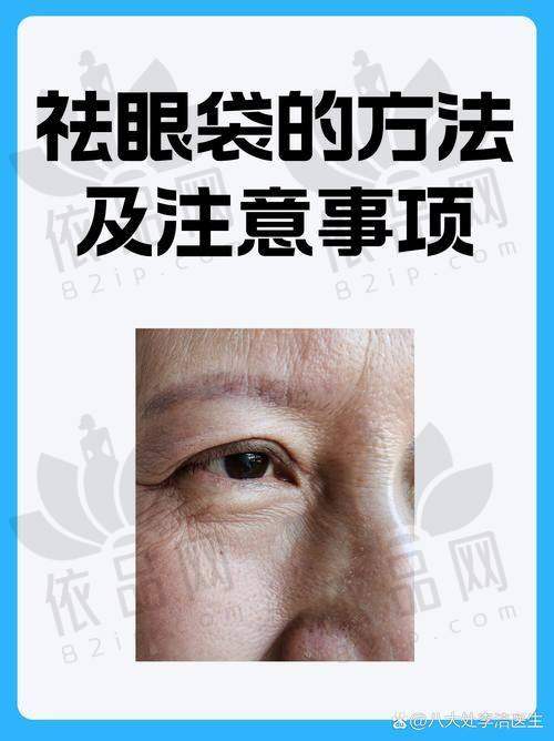 广州美莱陈贵宗祛眼袋价格