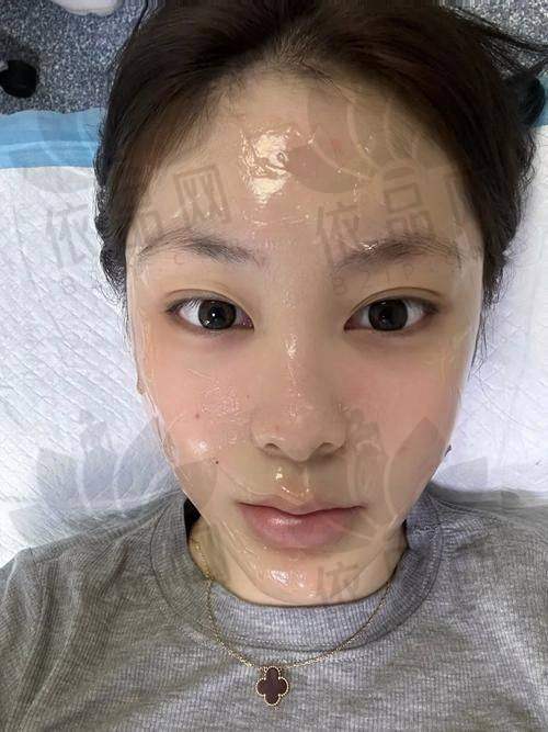 兰州臻韩美学医疗美容黑金超光子的优势