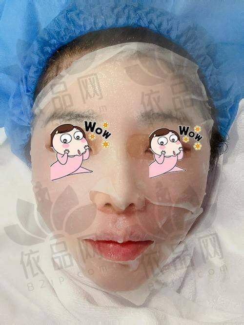 黑金超光子嫩肤的成效